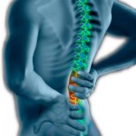 back-pain